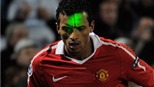 UEFA điều tra vụ chiếu tia laser vào cầu thủ M.U